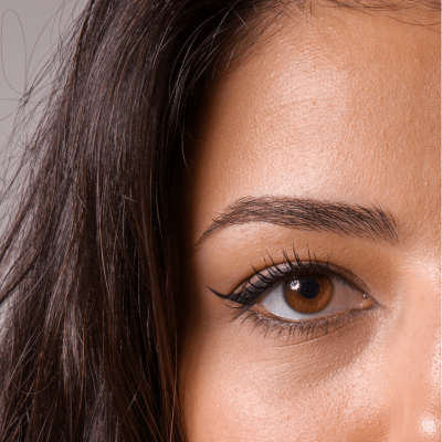 Closeup of woman's right upper quadrant of face, focused on eye and brow, representing brow lift