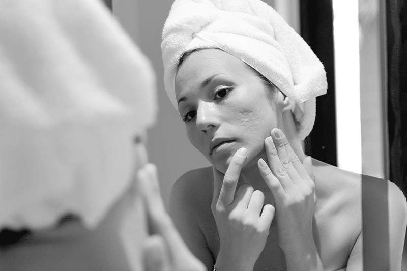 Woman Looking At Scars On Face