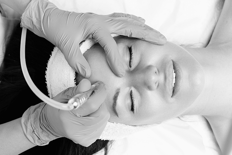 Woman at spa microdermabrasion